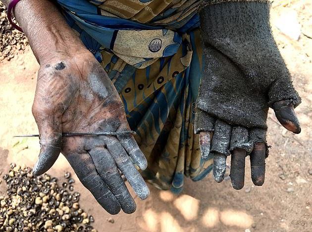 腰果行業中的印度女人：雙手被嚴重灼傷，時常疼得大叫-圖1