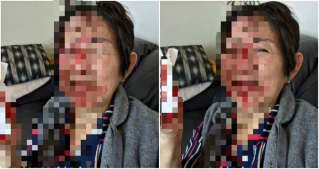 加拿大70歲亞裔老婦在傢遭陌生女子伏擊，無故被暴打全身沾滿鮮血-圖1