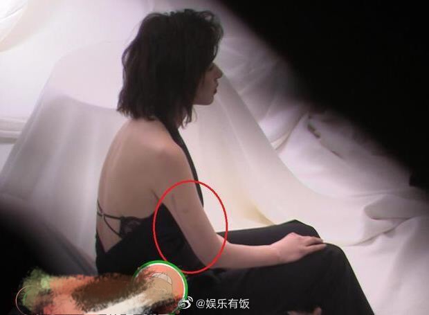 萬茜穿裸背裝性感迷人 手臂傷疤尚未恢復仍清晰可見-圖1