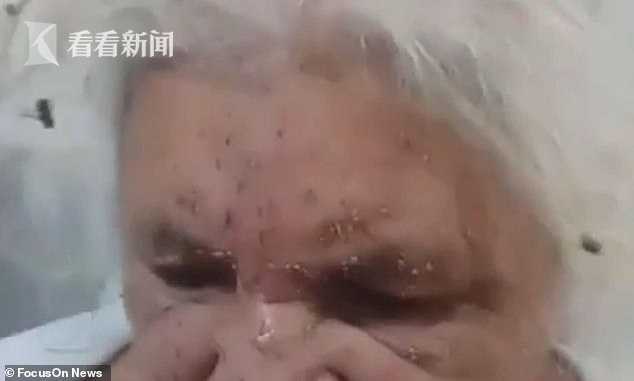 仨老嫗河邊捕魚遭蜜蜂群攻擊 72歲老太被蟄得滿臉毒針像撒瞭沙粒-圖1