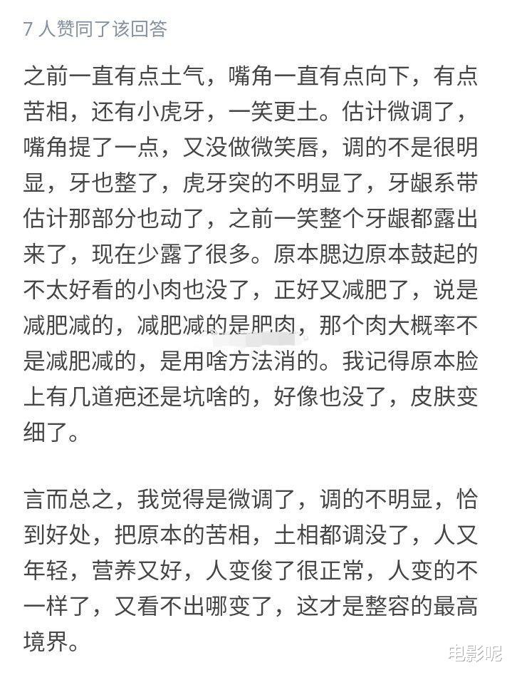網友發帖稱王俊凱面部微調瞭而不是減肥，還表示這是整容最高境界-圖1