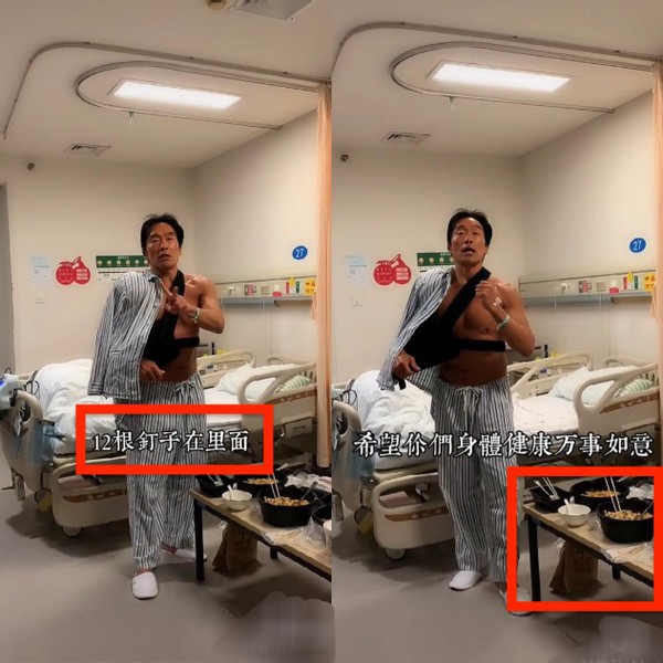 鄭浩南獨自住院太淒涼，56歲一身腱子肉，自曝體內有12根釘子-圖1