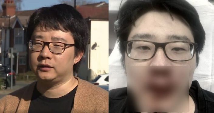 中國教師在英國遭4人圍毆: 
