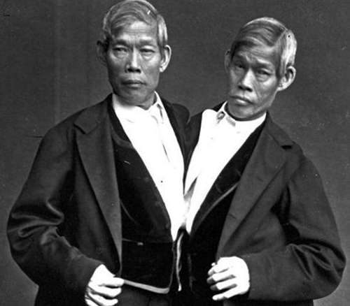 華裔連體兄弟靠表演走紅，娶一對英國姐妹生22個娃，63歲同天去世-圖1