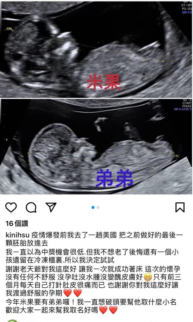 羅志祥43歲經紀人小霜宣佈懷二胎，仍是試管嬰兒，孩子父親不詳-圖1