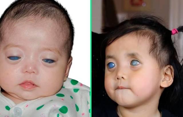 中國女孩一出生是“藍眼睛”被拋棄，美國夫婦跨國領養，如今怎樣-圖1
