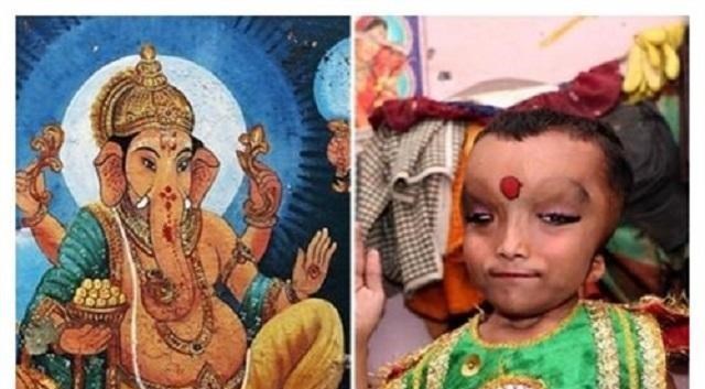 印度畸形男孩：外貌與象頭神撞車，受眾人跪拜，親爹都要下跪-圖1